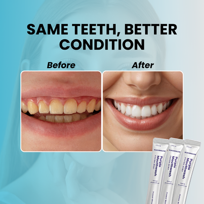 GlacierGlow - Instant Whitening Mouthwash